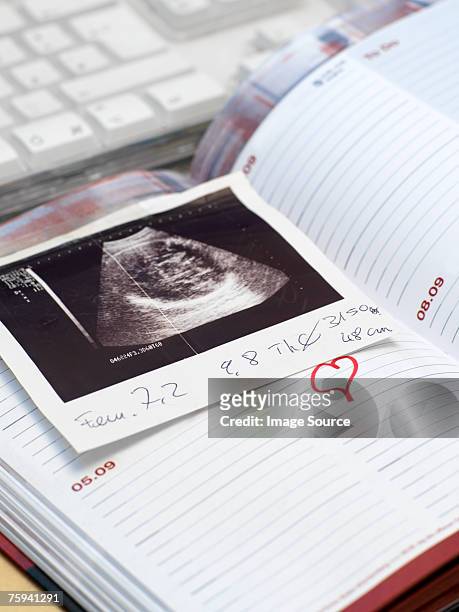 ultrasound scan in a diary - fetus heart stock pictures, royalty-free photos & images