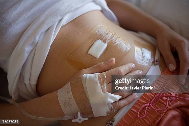 woman lying down after appendicitis laparoscopy surgery, mid section - apendicitis fotografías e imágenes de stock