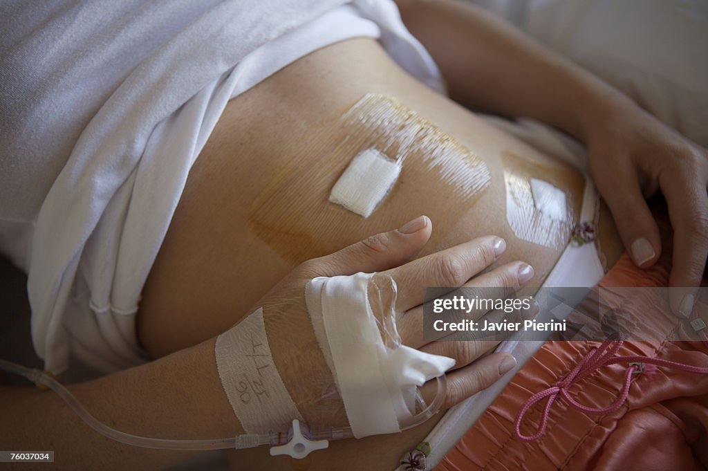 Woman lying down after appendicitis laparoscopy surgery, mid section