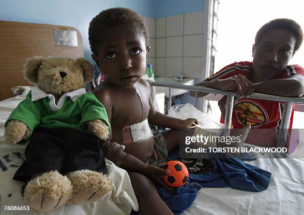 Goroka boy Junior Nike, age three, recovers in the Intensive Care Unit after Australian doctors performed open heart surgery on him during the 14th...