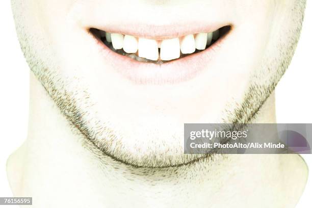 "young man's lower face, extreme close-up" - crooked teeth before after stock pictures, royalty-free photos & images