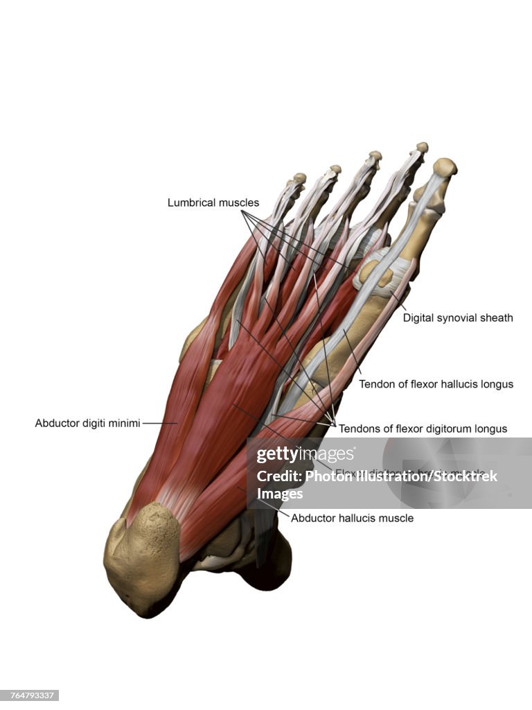 3D model of the foot depicting the plantar superficial muscles and bone structures with annotations.