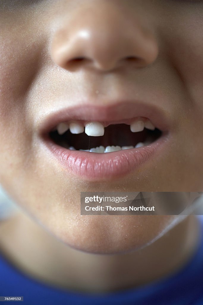 Boy (6-8) with gap in teeth, close-up