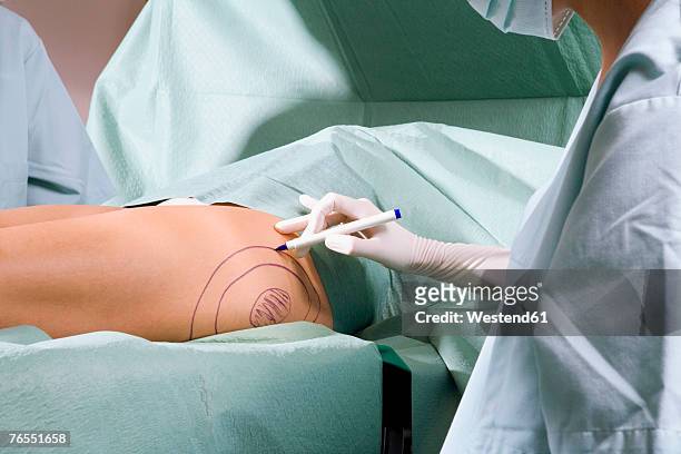 female surgeon at work - tratamento a laser imagens e fotografias de stock