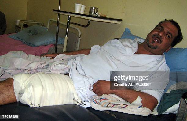 Retired Iraqi school teacher Abdel Amir Hassan lies injured at a Baghdad hospital, 22 September 2007. Hassan was wounded in a shooting incident...