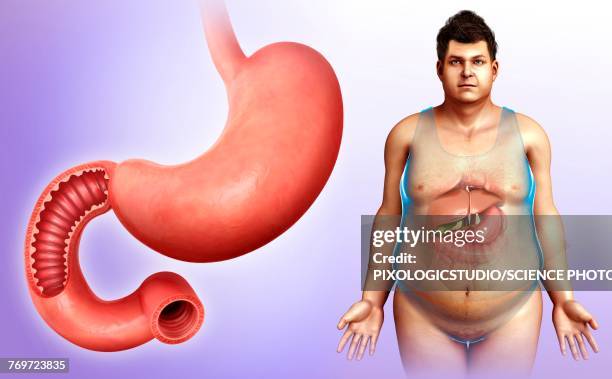 ilustrações de stock, clip art, desenhos animados e ícones de male stomach and duodenum, illustration - duodeno