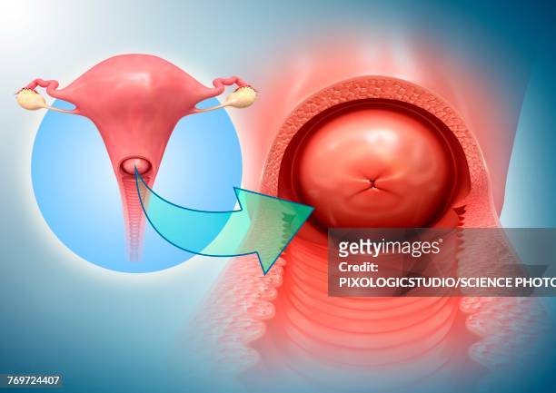 ilustraciones, imágenes clip art, dibujos animados e iconos de stock de female reproductive system, illustration - cervix