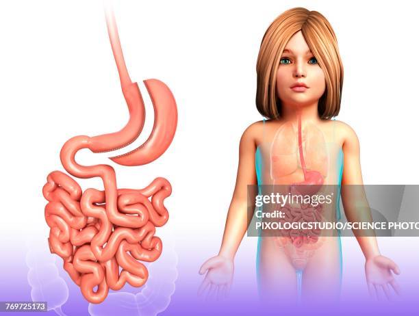 sleeve gastrectomy, illustration - gastric bypass stock illustrations