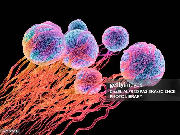 ilustraciones, imágenes clip art, dibujos animados e iconos de stock de cancer cells, illustration - melanocito