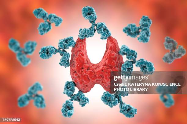 autoimmune thyroiditis, conceptual illustration - autoimmunity stock-grafiken, -clipart, -cartoons und -symbole