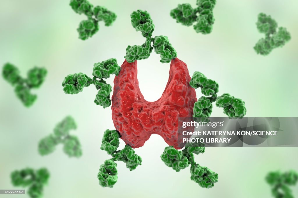 Autoimmune thyroiditis, conceptual illustration