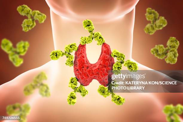 illustrazioni stock, clip art, cartoni animati e icone di tendenza di autoimmune thyroiditis, conceptual illustration - tiroide