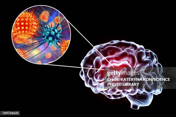 viral encephalitis, illustration - virus zika stock illustrations