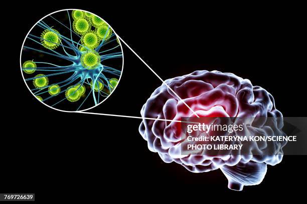 viral encephalitis, illustration - animal brain stock illustrations