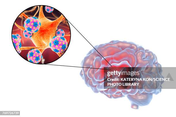 viral encephalitis, illustration - enterovirus stock-grafiken, -clipart, -cartoons und -symbole