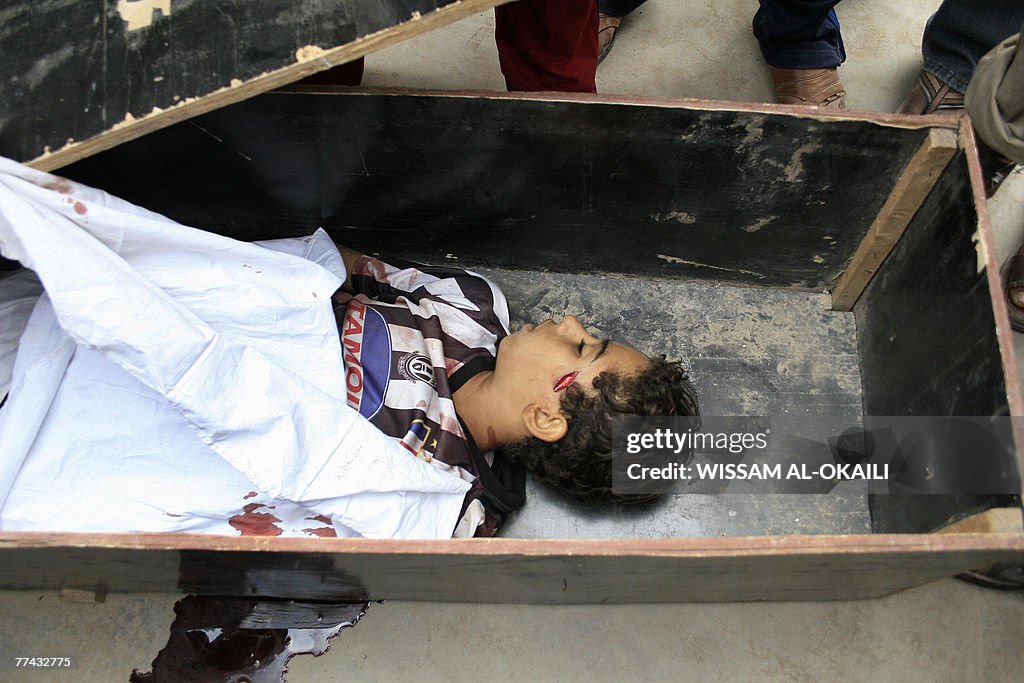 The body of an Iraqi boy killed during f