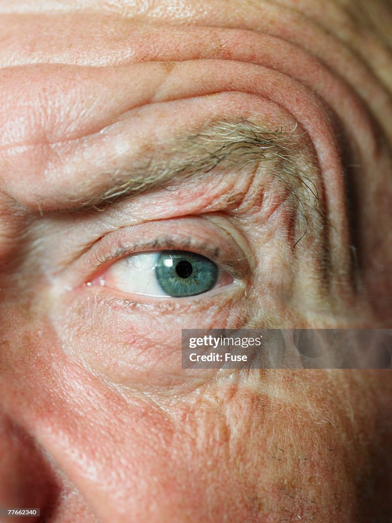Senior Man's Eye