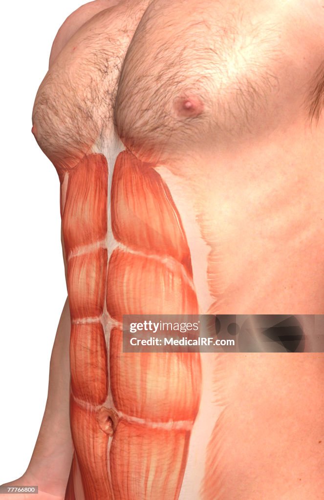 Rectus abdominis