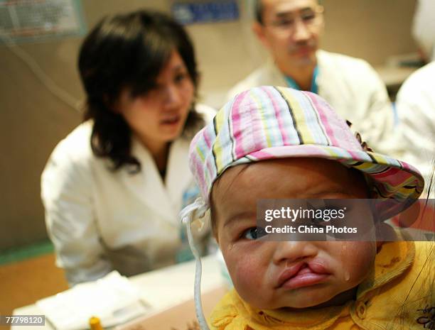 Child suffering from a cleft lip and palate waits for an examination at the Nanjing Drum Tower Hospital during registration for treatment at a...