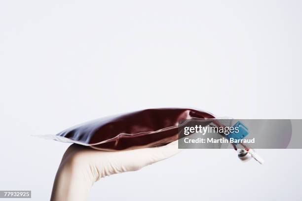 a gloved hand holding an iv bag full of blood - iv pump stock pictures, royalty-free photos & images