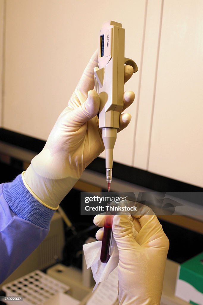 Hands performing blood test