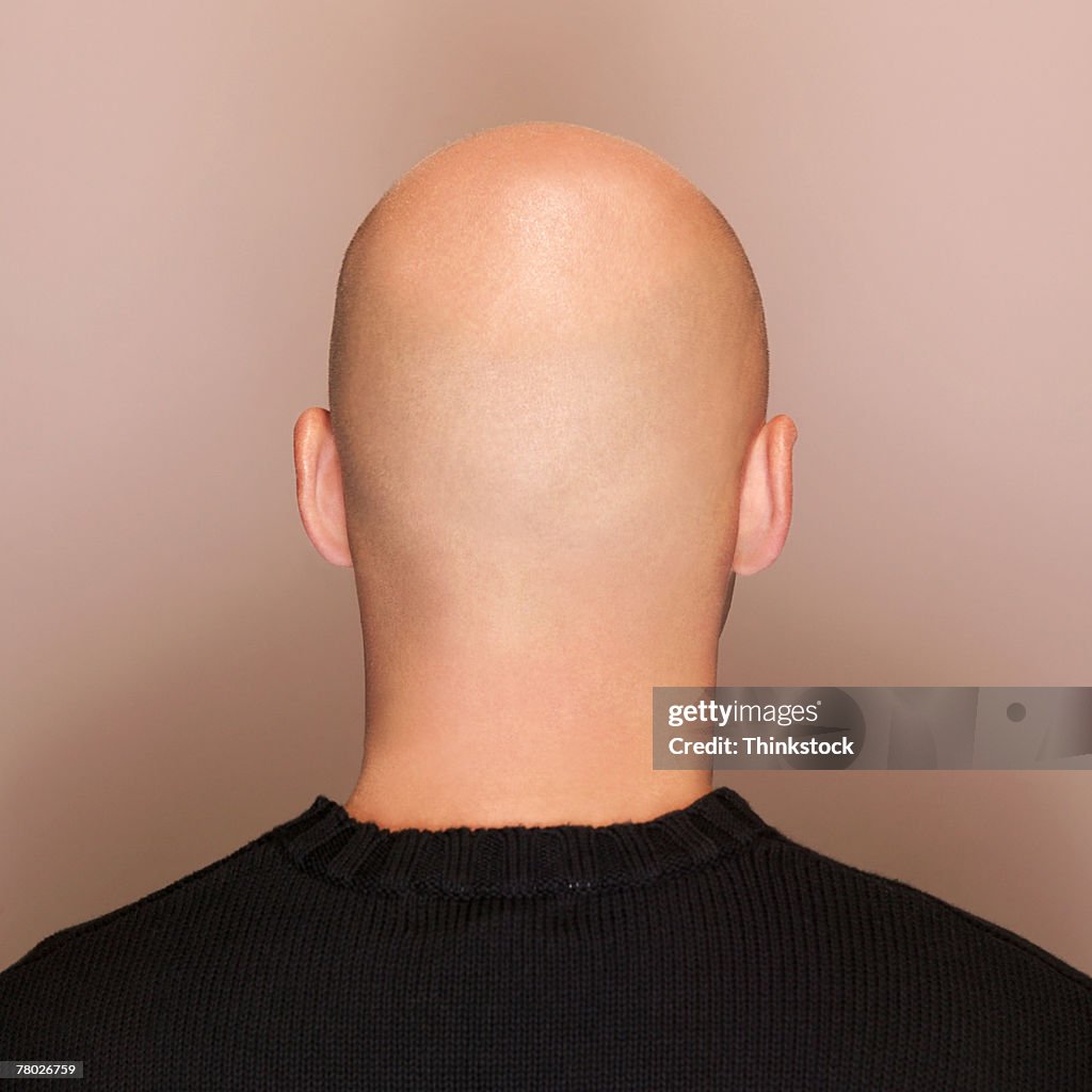 Rear view headshot of a man's bald head.