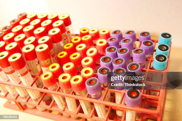 Vils Lab Lab Viles Photos and Premium High Res Pictures - Getty Images