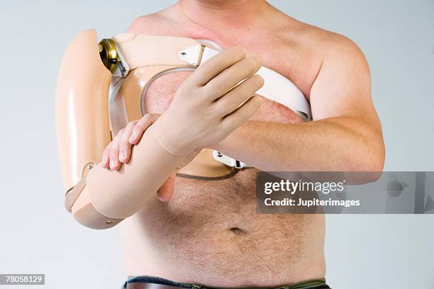 man with prosthetic arm - artificial arm stock pictures, royalty-free photos & images