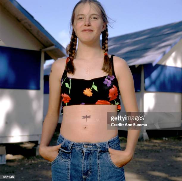 Kristine Martin isn''t embarassed by her surgical scars at Camp Del Corazon because all the campers here suffer from heart problems, many of them...