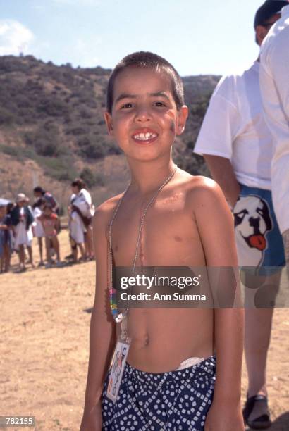 This young boy isn''t embarassed by his surgical scars at Camp Del Corazon because all the campers here suffer from heart problems, many of them...