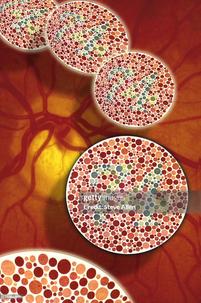 Color blindness in eye