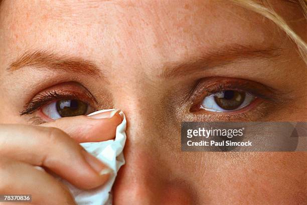 sad woman with tissue - rubbing eyes stockfoto's en -beelden