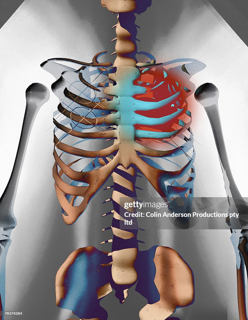 Human skeleton