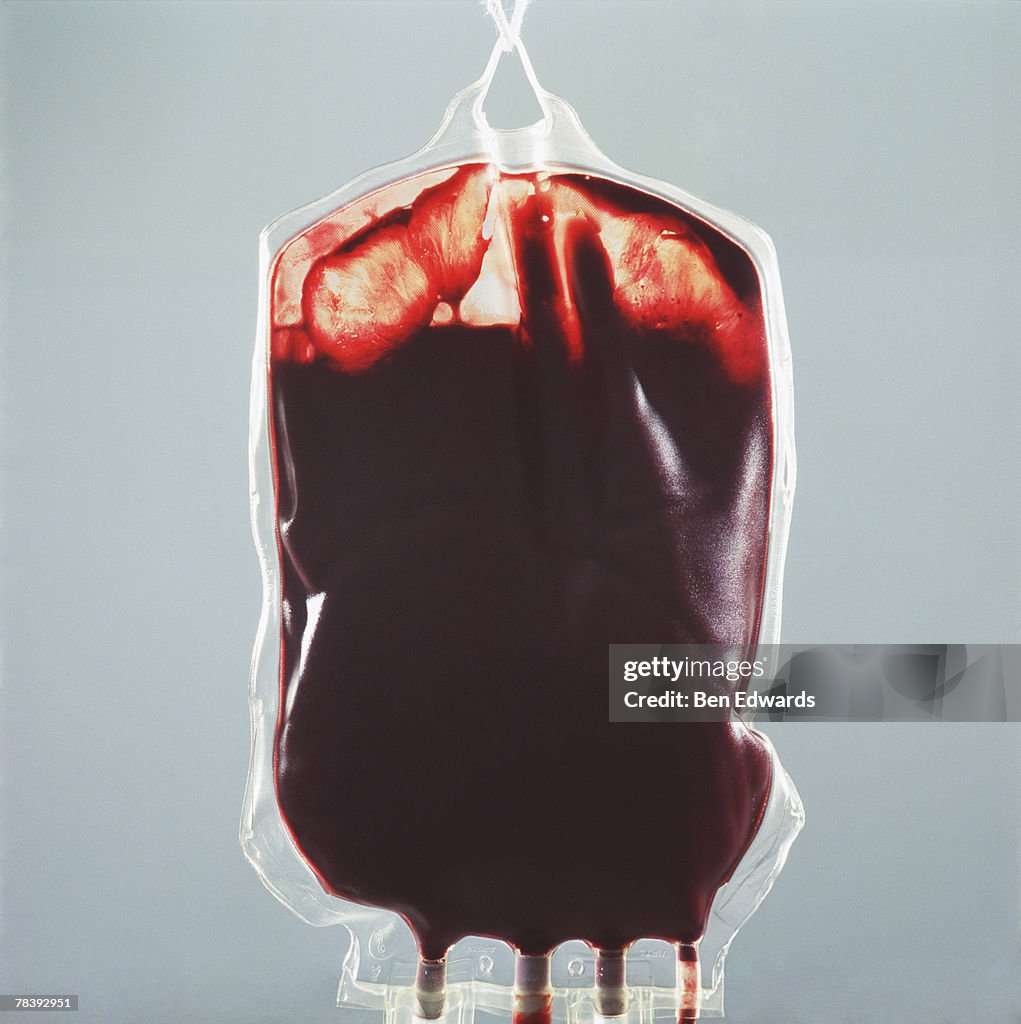 IV bag of blood