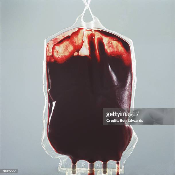 iv bag of blood - blood bag stock pictures, royalty-free photos & images