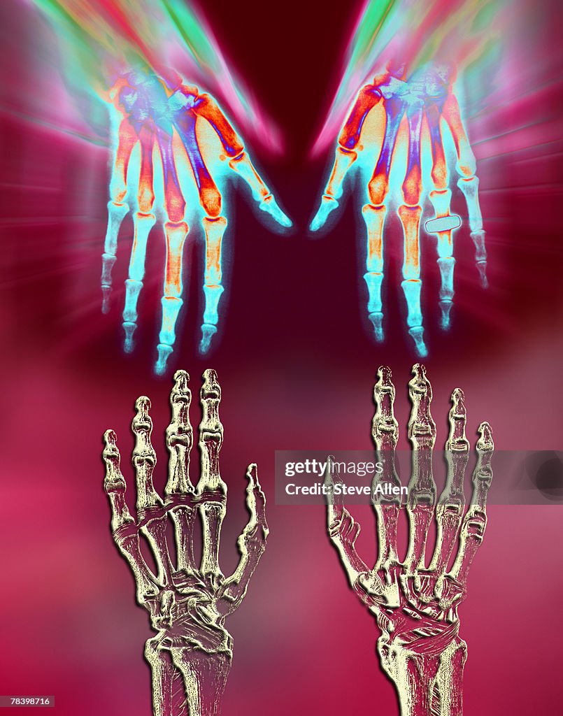 Skeleton hands