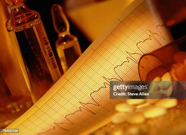 electrocardiogram - ampoule dessin stockfoto's en -beelden