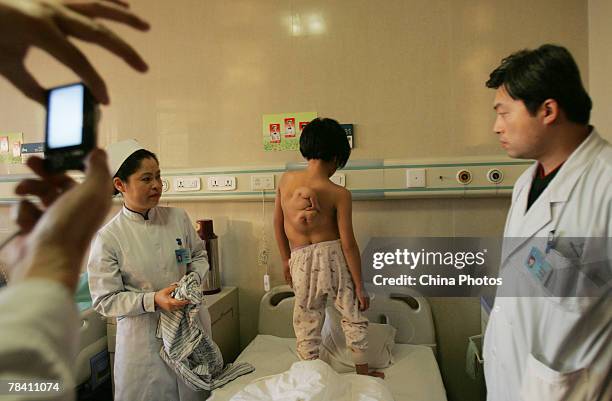 Eleven-year-old Chinese girl Ren Xin, who has an excrescent hand on her back, is checked by doctors prior to surgery, at the Armed Police General...