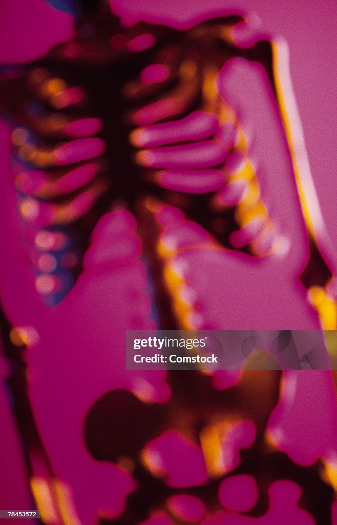 Blurred skeleton torso