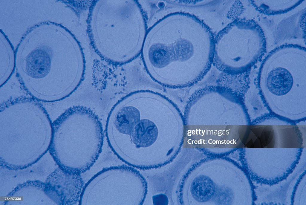 Ascaris bivalent mitosis magnified 200x
