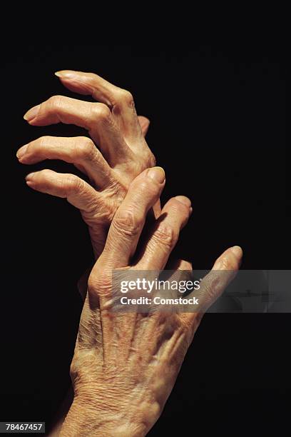 hands of elderly person - ausgemergelt stock-fotos und bilder