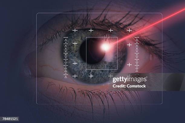 laser beam on eye - eye doctor stock pictures, royalty-free photos & images