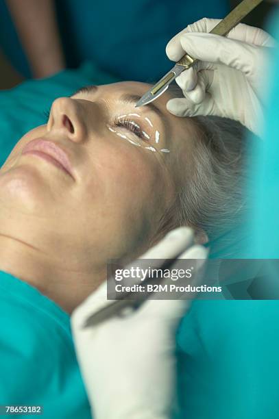 woman undergoing eyelid surgery - plastischer chirurg stock-fotos und bilder