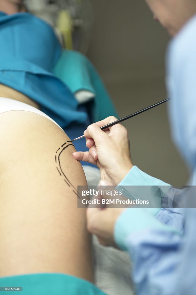Doctor preparing woman for liposuction