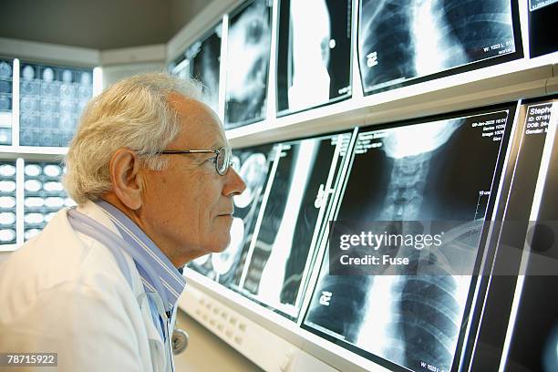 physician examining x-rays - radiogram photographic image stock-fotos und bilder