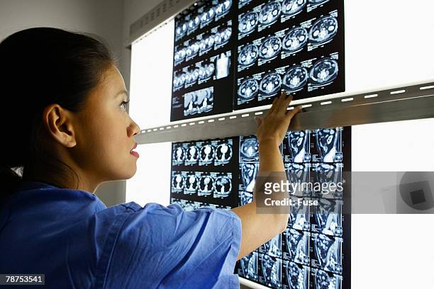hospital doctor looking at x-rays - radiogram photographic image stock-fotos und bilder