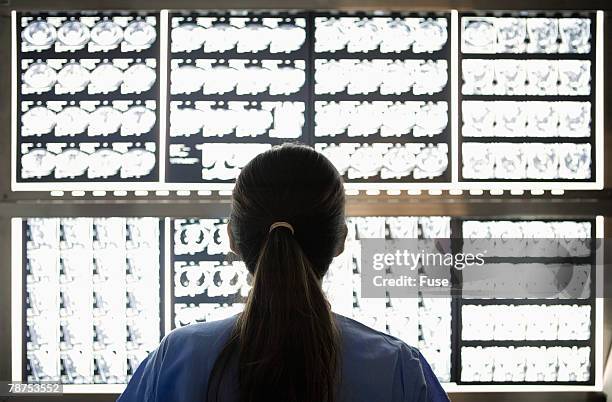 hospital doctor looking at x-rays - back lit doctor stock pictures, royalty-free photos & images