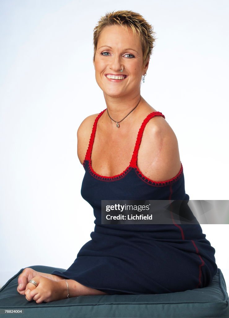 British artist Alison Lapper, who posed for a sculpture by Marc Quinn ...