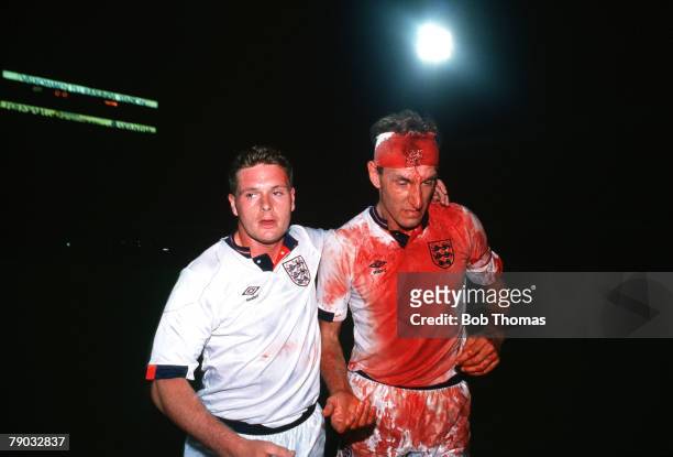 Sport, Football, World Cup Qualifier, Stockholm, 6th September 1989, Sweden 0 v England 0, England's Terry Butcher walks off the field covered in...