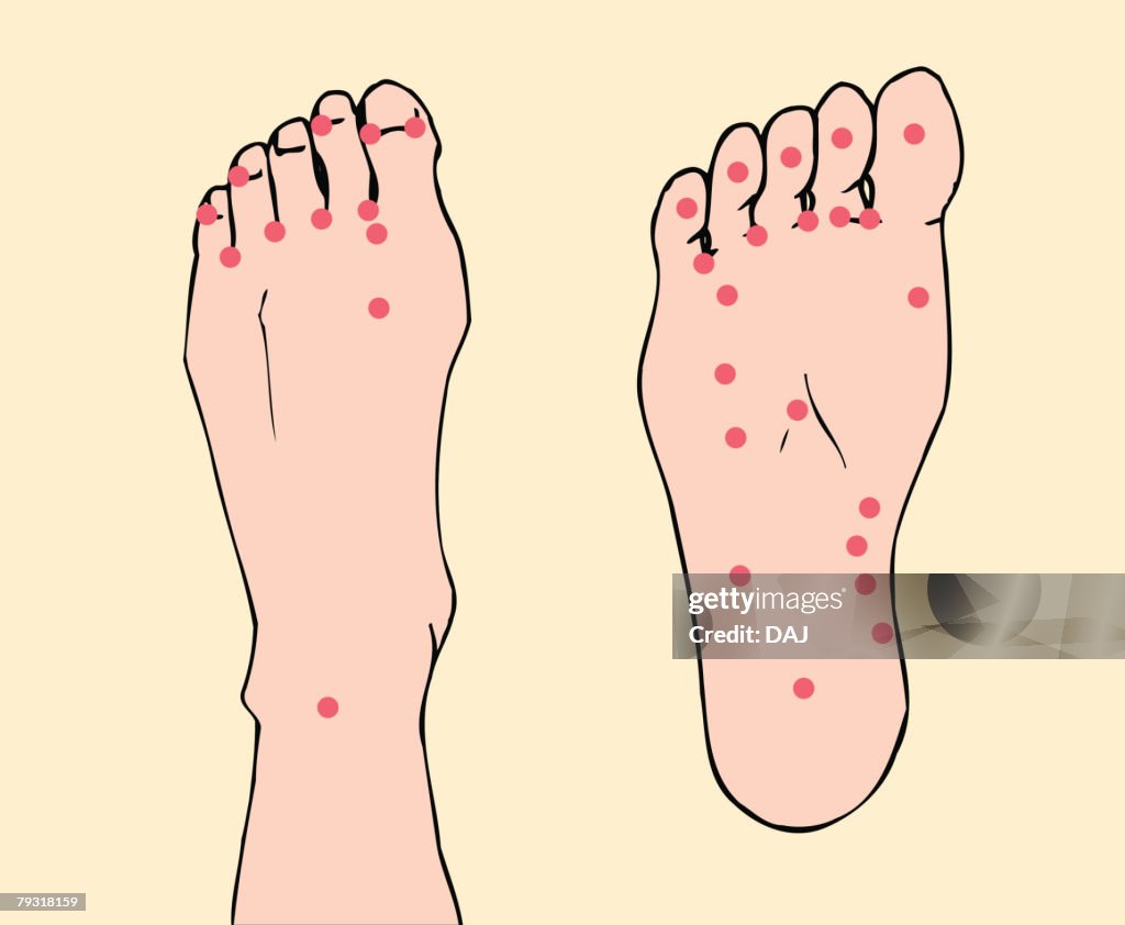 Acupressure points of feet, close up